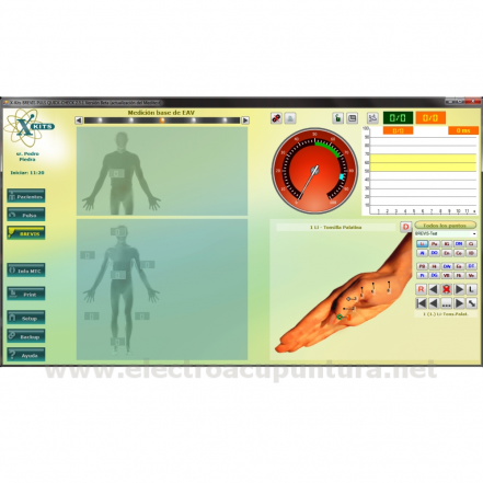 Software X-KITS Brevis PV