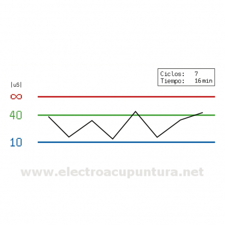 EASY de KINDLING aparato de Biorresonancia clásica